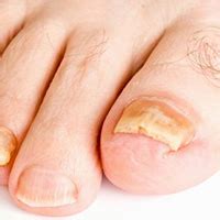 Dermis Clinic | Adyar | Chennai | Dermatologist | Cosmetologist | Laser ...