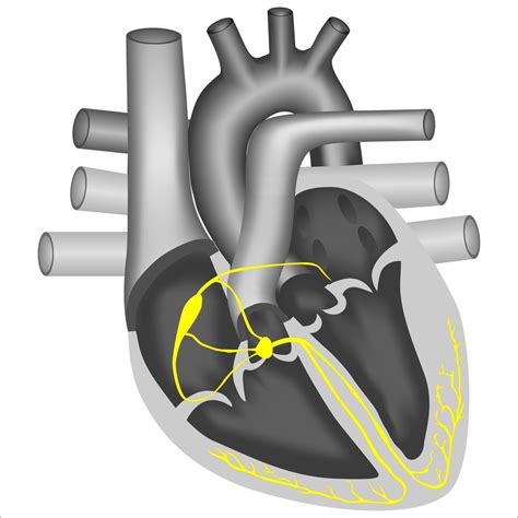 Cardiac Physiological Pacing for Pacemaker (CPP) | WWMG Blog