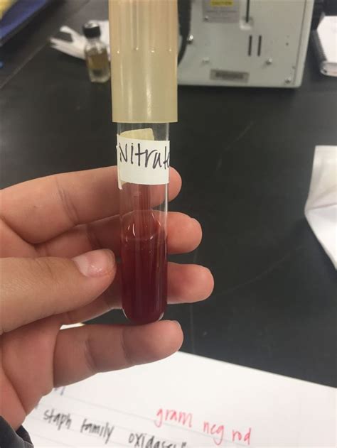 Image result for Positive Nitrate Test
