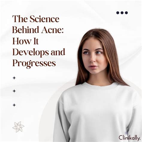 Ultimate Acne Treatments: Overnight & Lasting Solutions | Clinikally