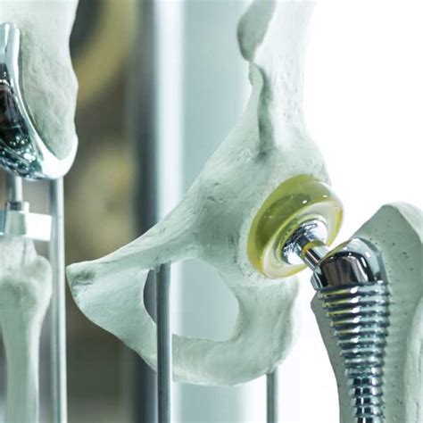 Best Gynaecology And Orthopaedic Treatment In Dombivali