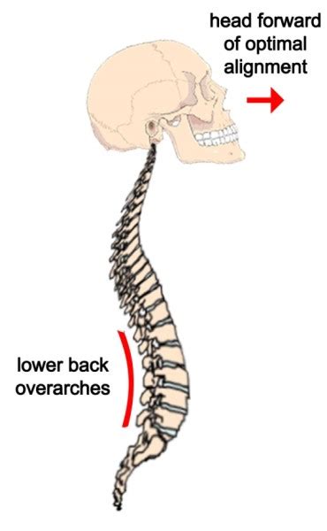 Lower Back Alignment 的图像结果