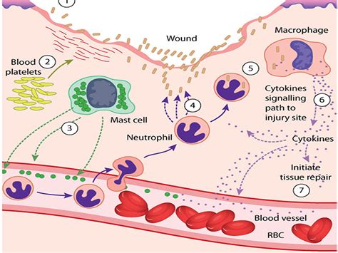 Image result for Inflammation Reaction
