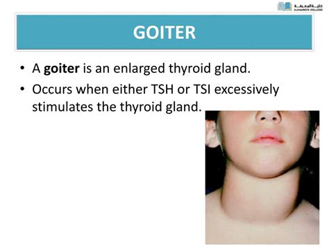 Image result for Thyroid Prediction Using Machine Learning