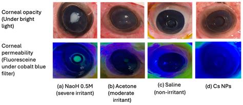 Exploring the Ocular Absorption Pathway of Fasudil Hydrochloride ...