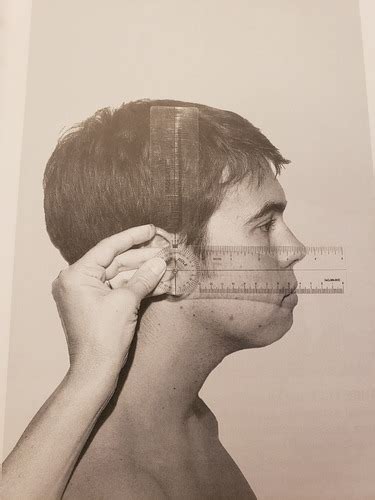 Image result for Cervical Rotation Goniometry
