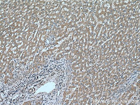DIO1 antibody (11790-1-AP) | Proteintech