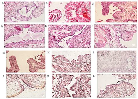 Spasmolytic and Uroprotective Effects of Apigenin by Downregulation of ...