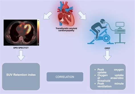 Cardiopulmonary Exercise Testing Correlates with Quantitative Left ...