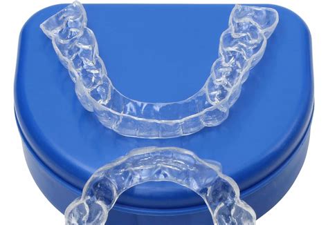 Orthodontic Retainer Braces