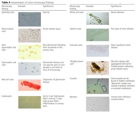 Atlas of Urine Microscopy Findings
