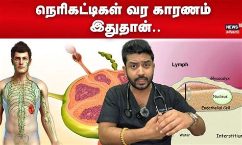 நெரிகட்டிகள் வர காரணம் இதுதான்.. | Reason Of Lymph fluid | N18V