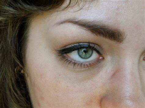 Watery Eyes - Symptoms And Causes - Times News UK