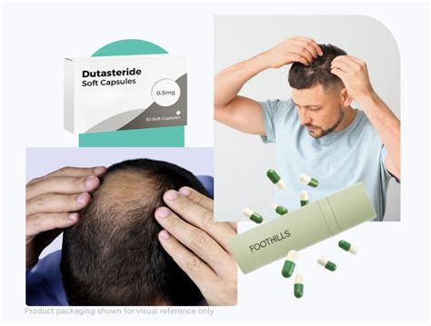 Dutasteride for hair loss: How to get it?