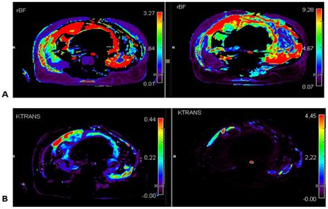 Assessment of the Mechanisms of Action of Eribulin in Patients with ...