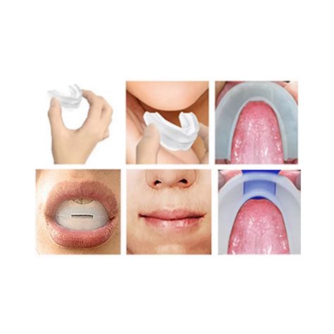 AVB Special Custom Fit Anti-snoring Device Mouthpiece - Cureka