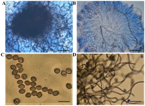Isolation of Potato Endophytes and Screening of Chaetomium globosum ...