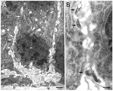 CagA Effector Protein in Helicobacter pylori-Infected Human Gastric ...