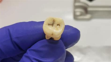 Image result for DNA Solves