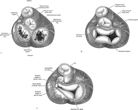 Atrioventricular Valve