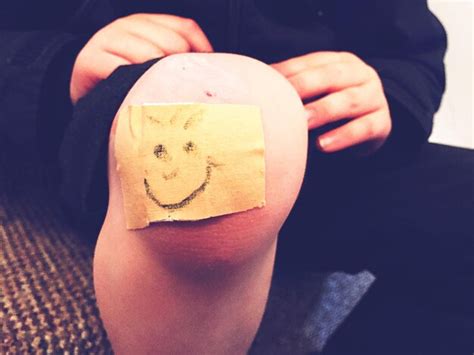 Bandage 的图像结果