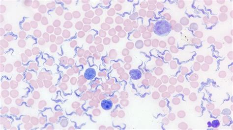 ZEISS Axiolab 5 smart microscope for easy digital documentation