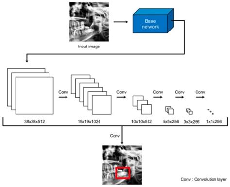 Deep Learning-Based Prediction of Paresthesia after Third Molar ...