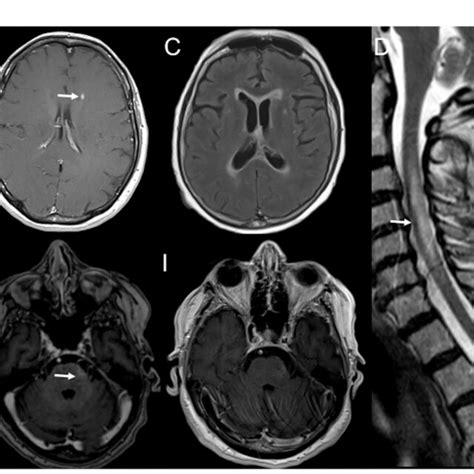 Serial Brain 2 的图像结果