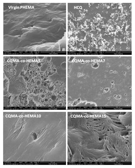 Copolymer Involving 2-Hydroxyethyl Methacrylate and 2-Chloroquinyl ...