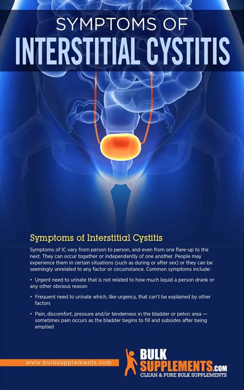 Interstitial Cystitis: Symptoms, Causes & Treatment