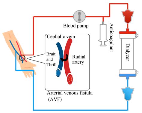 Quantification and Visualization of Reliable Hemodynamics Evaluation ...