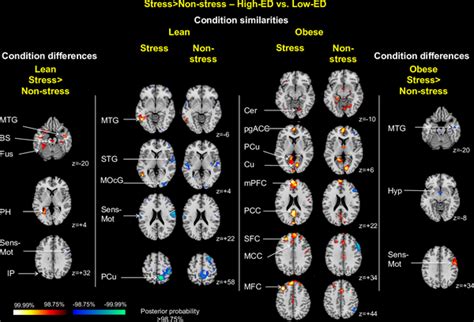 Cingulate cortex Disorders 的图像结果