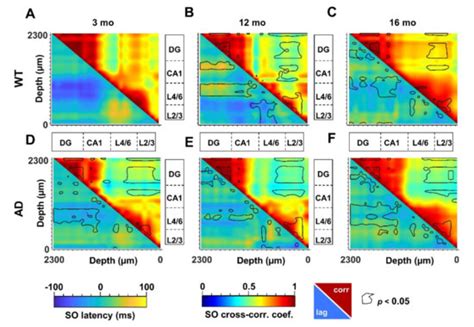 Accelerated Aging Characterizes the Early Stage of Alzheimer’s Disease