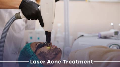 Know About Laser Acne Treatment By Dr. Sneha Gupta