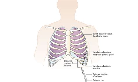 Jaipur Vascular and Intervention Radiology
