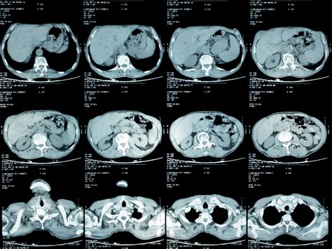 What can I expect from my abdominal MRI? • Touchstone Medical Imaging