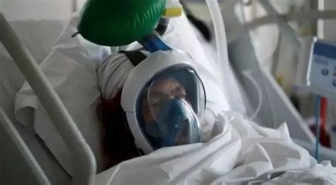 COVID-19 May Cause Brain Damage In Even Milder Cases, Claims Study