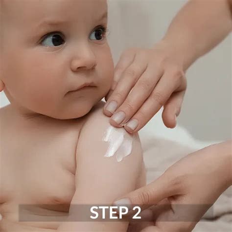 Hoopoe Anti Rash Face Cream – Fixderma Skincare