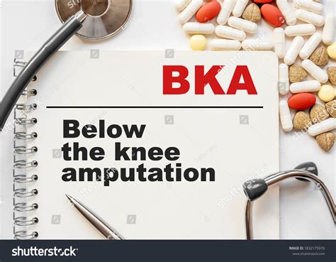 Page Notebook Bka Below Knee Amputation Stock Photo 1832175976 ...