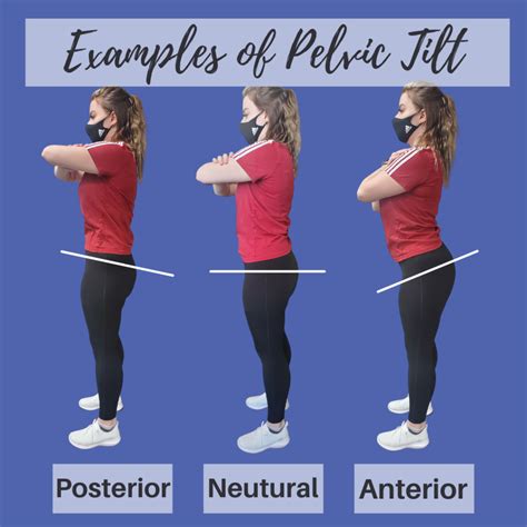 Posterior Pelvic Tilt What Is A Pelvic Tilt? Body Focus