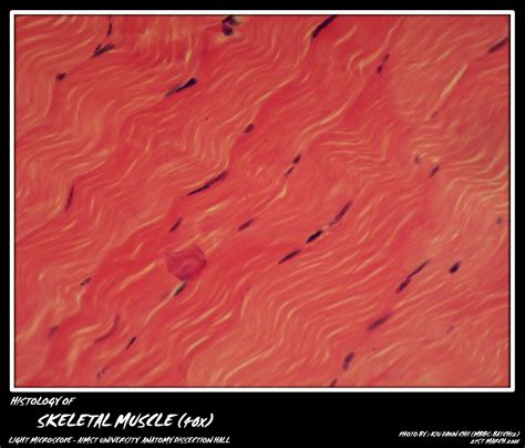 Skeletal Muscle Microscope