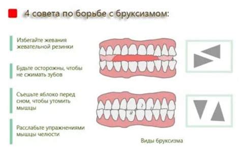 Бруксизм – причины и лечение у взрослых и детей