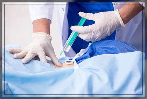 Image result for Epidural Injection Procedure