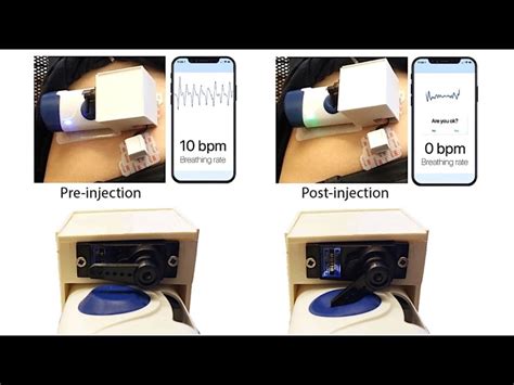 Researchers Use Wearable To Detect And Reverse Opioid Overdoses In Real ...
