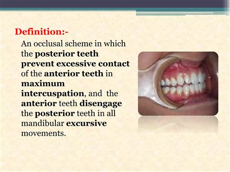 Occlusion in dentistry | PPTX