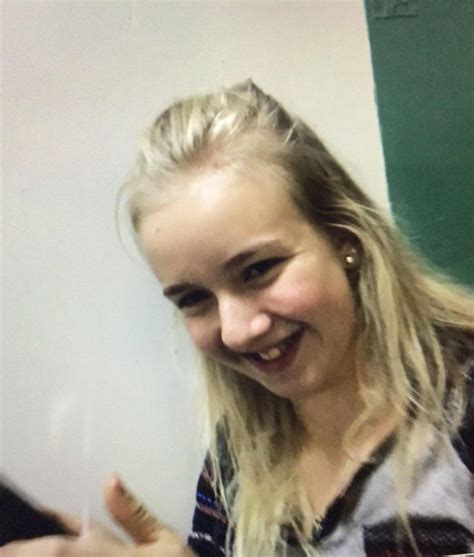 (Related to my last post) Before & After Sarpe Surgery : r/jawsurgery