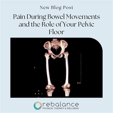 5 Common Causes of Pain During Bowel Movements and the Role of Pelvic Floor