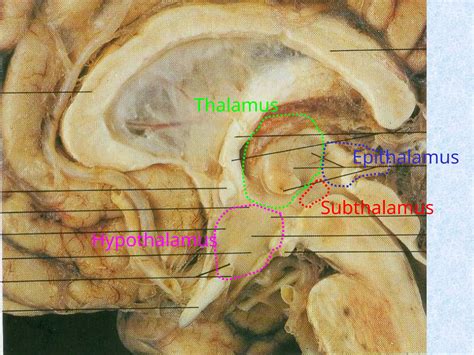 Parts of the brain and function and general features | PPSX