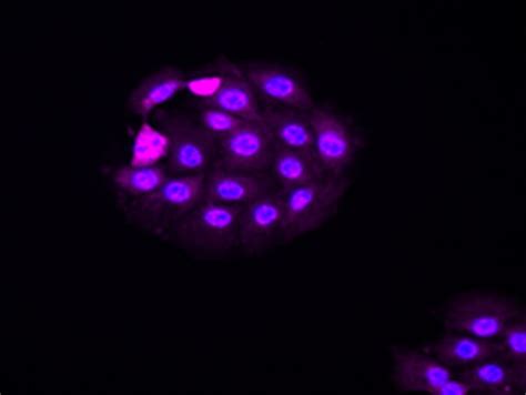 MOC2 Mouse Oral Squamous Cell Carcinoma (OSCC) Cell Line | SCC470