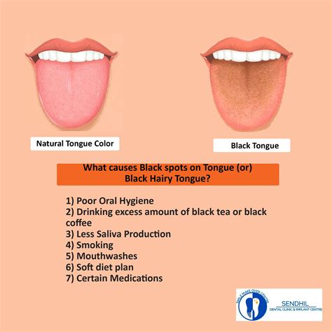 Medical Terminology For Black Tongue at Gerald Parish blog